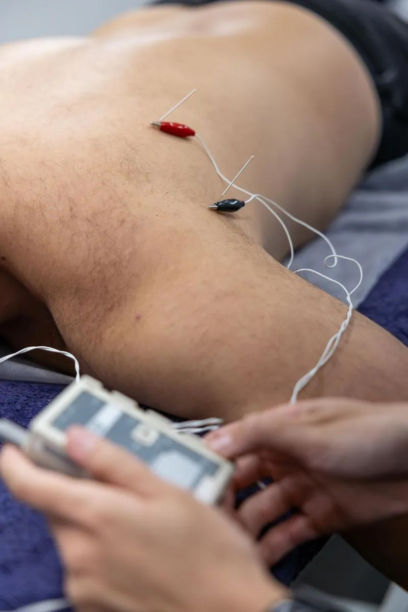 Percutaneous neuromodulation